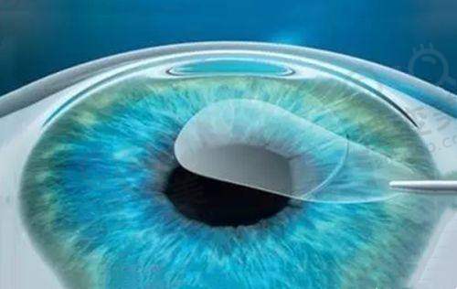 王乐今私立医院地点和出诊时间:在北京熙仁眼科预约挂号王乐今医生更容易——预约挂号方式