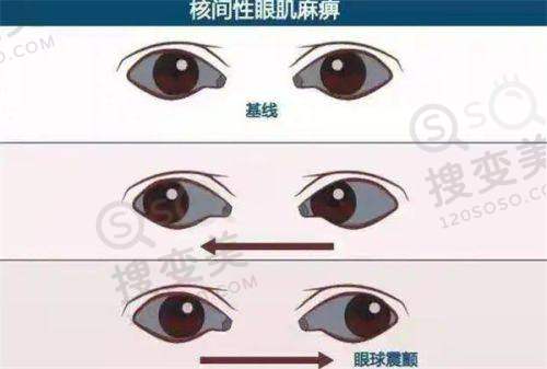 乌鲁木齐普瑞眼科医院收费贵吗？给大家整理了乌市普瑞眼科医院价格表~收费真不贵——近视手术价格及优势