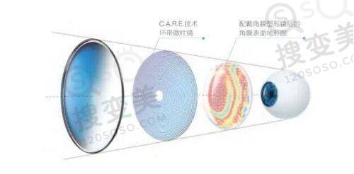 昆明眼科医院做圆锥角膜交联手术的人多吗？未来发展趋势展望