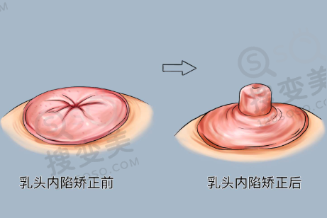 南京江北固德口腔医院靠谱吗？来听听大家看牙后的反馈评价到底怎么样——牙齿矫正实例成效感受