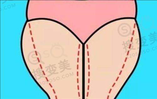 双眼皮修复的十大杰出医生排名公开:都是国内做眼修复有名的医生——魏志香医生