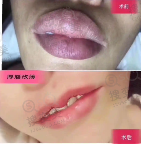 上海眼修复好的医生排名前十之刘志刚