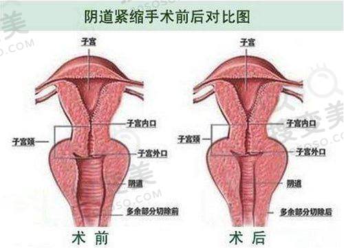 濡白天使副作用和缺点是什么？——成效感受分享