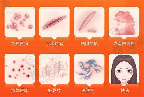 男士丰胸如何避免被家人发现：术前准备策略