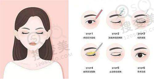 上海眼修复好的医生排名前十之朱迪