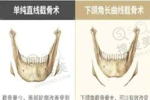双眼皮修复的十大杰出医生排名公开:都是国内做眼修复有名的医生——师丽丽医生