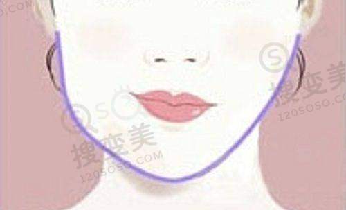 男士丰胸如何避免被家人发现：与家人的沟通技巧