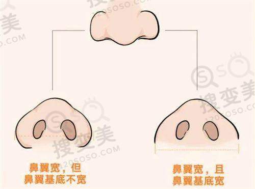 上海整形医院排行榜前十名包括哪些——综合分析与选择建议