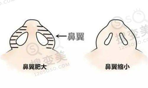 南京蓝鲟口腔医院怎么样之性价比