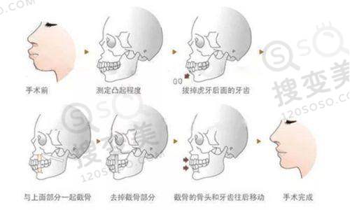 国内口腔医院排名前十表:位于北京、南京、天津等多地,华 西必须算上!——其他上榜医院特色