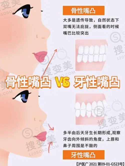 北大口腔正颌医生排名top之王晓霞医生