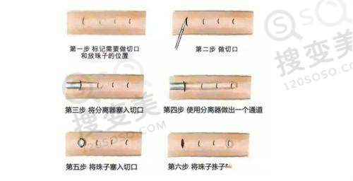 南京固德口腔医院怎么样之矫正技术优势