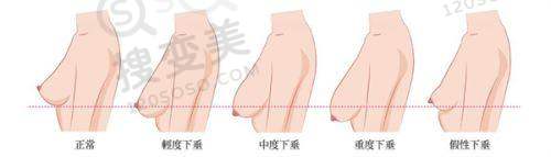 srt100浅放哪个医院有？分享国内各地医院的治疗选择及费用解析——福建和其他地区医院