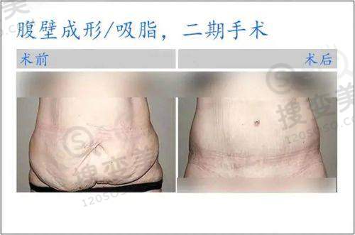 中国口腔医院排名前十表：位于北京、南京、天津等多地，华西技术强价透明口碑好 