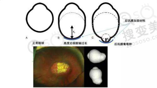 西安近视眼手术医院排名榜:其他上榜医院特色