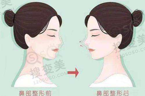 上海眼修复好的医生排名前十之魏志香