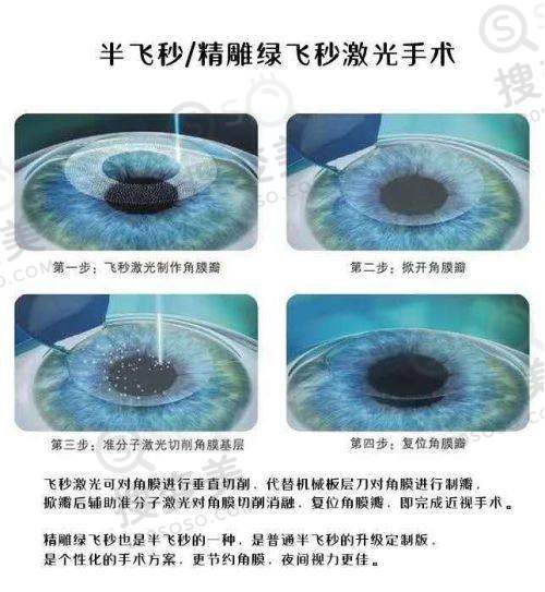 北京同仁眼科熊瑛和李婧哪个医生好?看完具体介绍和评价便知附挂号——李婧医生介绍