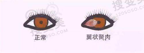 南宁爱尔眼科医院上班时间：就诊注意事项