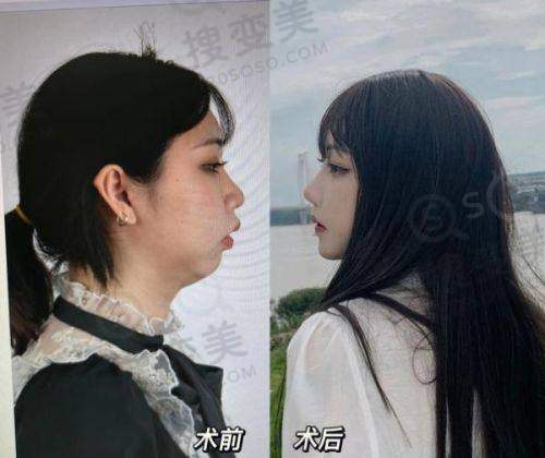深圳十大正规整容医院排名公布，排名前三的整形医院尤其出名哦——深圳艺星医疗美容医院