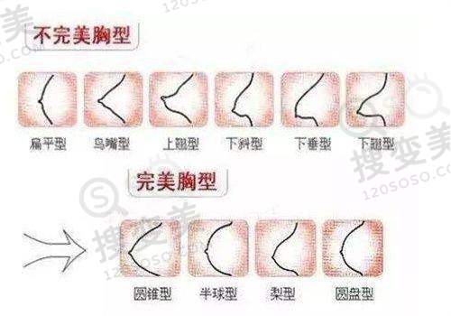 新疆喀什昕整医疗美容医院怎么样？眼/鼻/胸技术靠谱