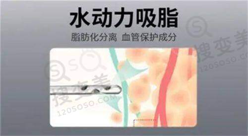 深圳十大正规整容医院排名公布，排名前三的整形医院尤其出名哦——其他上榜医院情况