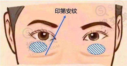北京艺星王博谦简介：美眼大师创举幼态眼/美杜莎双眼皮技术！北京艺星坐诊预约——隆胸技术特色