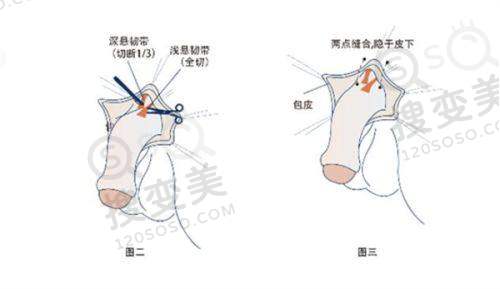 新的重庆十大医美整形医院排名之重庆华美整形外科医院
