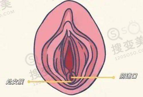 谁找深圳王天国做过桃花鼻？靠谱吗？从隆鼻优势及审美来看——医生背景与医院情况