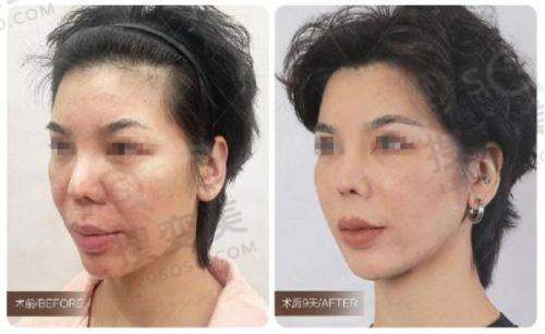 珠海整形好医院排名分享，公布2025年当地人心目中十家医美好医院名单！——医院医生团队与口碑评价
