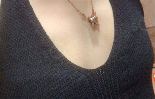 昆明韩辰整形怎么样?医生技术好且价目透明，双眼皮3000+隆鼻5000+ 
