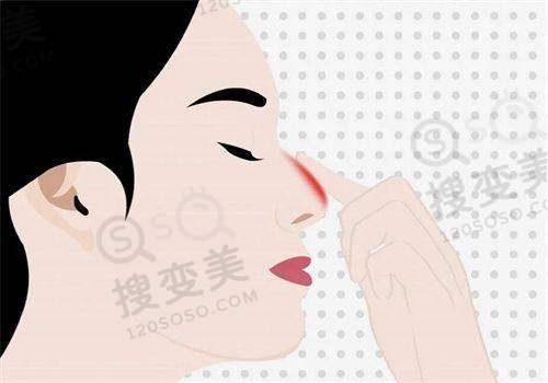 手慢无！深圳艺星医疗美容预约挂号全攻略，一文读懂医院实力与口碑关键词——挂号攻略要牢记