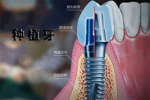 昆山鲸华口腔靠谱吗？医生技术优、收费透明、口碑高，速来预约！ 