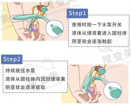 杭州整形医院排名前十位之其他医院隆胸相关情况