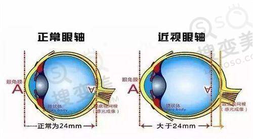 新疆四七四医院眼科几点开诊?营业时间、地址及近视手术价格全揭秘！ 