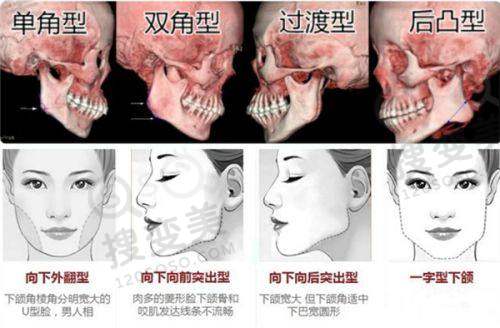 4mg薇旖美打眼部够用吗——亲测成效及维持时间