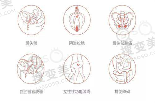 广州做八爪鱼紧缩术哪家医院做得好？成都棕南医院成效好，收费合理口碑高 