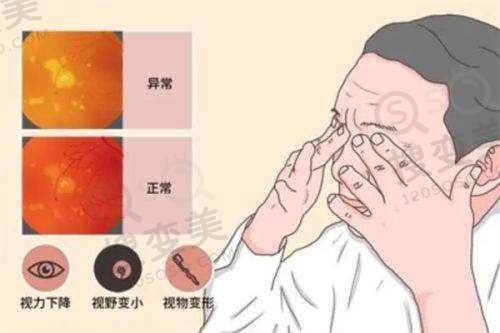 连云港市第一人民医院眼科张自平怎么样?做近视手术特别靠谱可预约——医院眼科科室实力