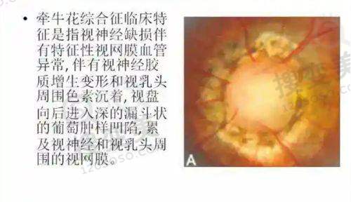 江门爱尔新希望眼科医院是国有还是私立?正规私立二级,倾听患者口碑