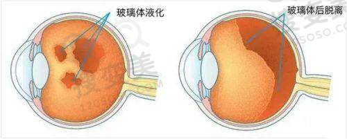 广州晶亮眼科医院怎么样?与上榜30家眼科对比,优势究竟在哪?——特色服务方面