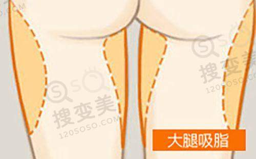西安正规整形医院有哪些?西安这5家口碑好的整形医院都正规——西安米兰柏羽医美口腔医院
