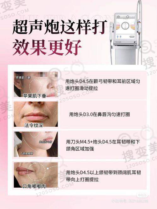 北京奥尔贝德医院整形口碑大起底！10+网友热评，透明收费与医生技术获赞 