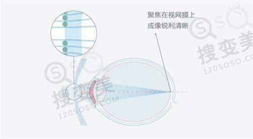重庆千叶眼科医院地址+营业时间公布:地址在九龙坡区石桥铺——医院地址及交通路线