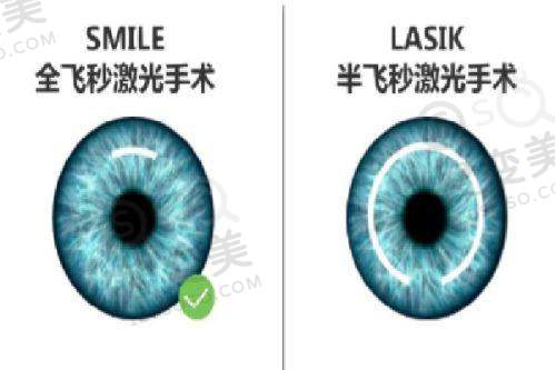 上海黑马眼科怎么样?专注近视手术实力强