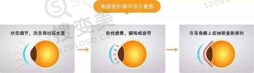 深圳深东爱尔眼科医院怎么样？规模大科室全，臧晶等医生技术优价格合理 