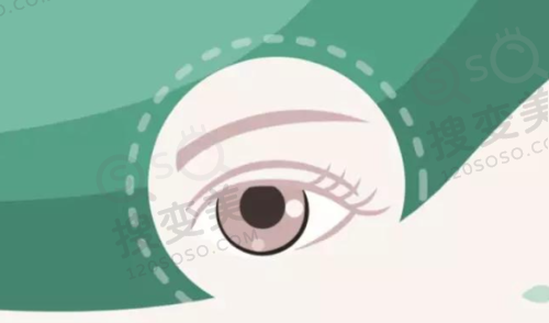 上海黑马眼科怎么样?地址及预约方式介绍
