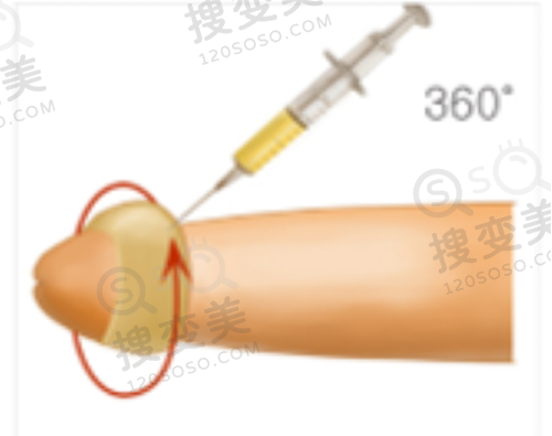 沈阳做拉皮手术医院排行前十有哪些?10家都是当地顾客反馈口碑好性价比高的人气医院——辽宁沈阳整形医院
