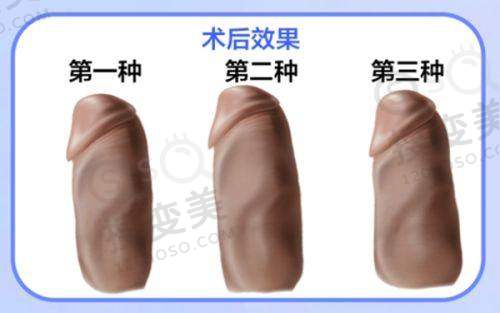 上海馥兰朵医院是正规医院吗?从与渠道医院对比来看