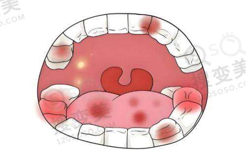 9、宁夏银川诺贝尔口腔医院真人口碑评价怎么样？