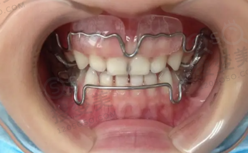 2、沈阳沈河威尔默口腔门诊部是正规医院吗？