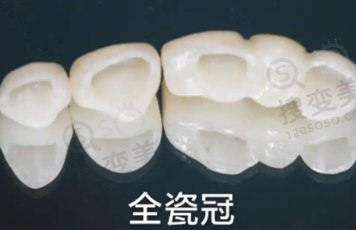 4、上海上远妙镜口腔门诊部特色项目及技术优势